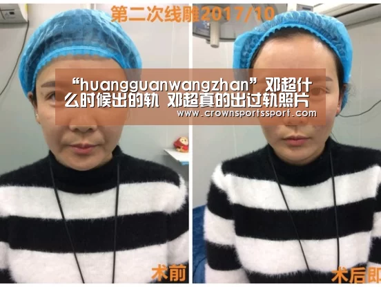 “huangguanwangzhan”邓超什么时候出的轨 邓超真的出过轨照片为证是什么鬼(图2) 皇冠官方网